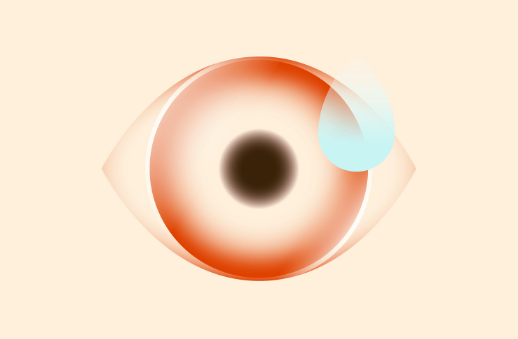 Syndróm suchého oka